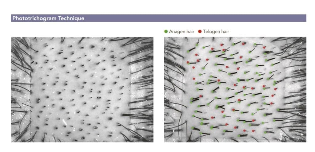 Solution Hair Booster